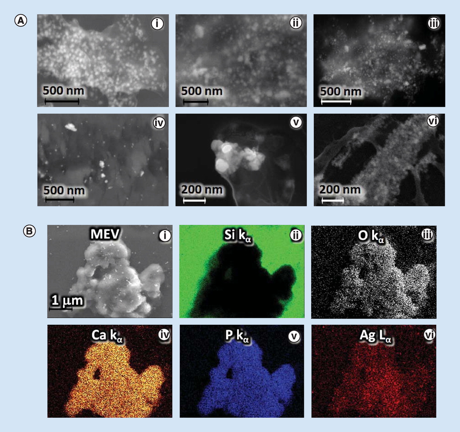 Green synthesis of silver nanoparticles combined to calcium glycerophosphate: antimicrobial and antibiofilm activities