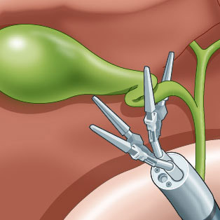 5W Samples - Endoscopic Surgery