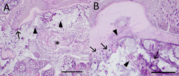 Photomicrographs from a mountainous star coral (Montastraea cavernosa) in Florida, USA.  