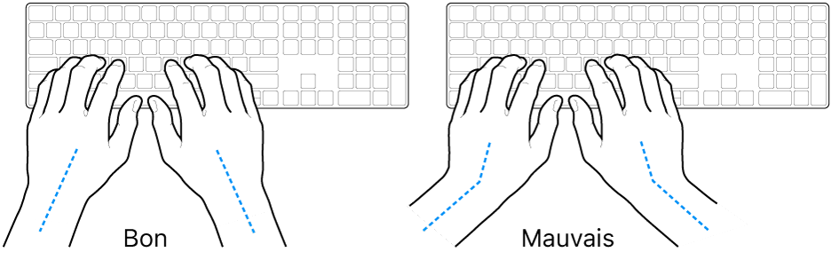 Mains placées sur un clavier, montrant le bon et le mauvais alignement des poignets et des mains.