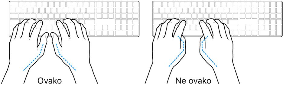 Ruke položene na tipkovnicu s prikazom pravilnog i nepravilnog položaja palaca.