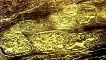 Examine how a subcutaneous fat layer supplies nutrients to dense connective tissue and epithelial cells