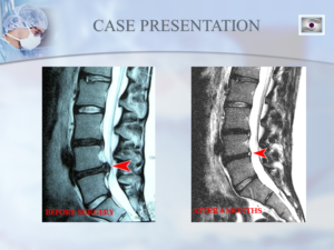 dr-luis-lombardi-case-1a