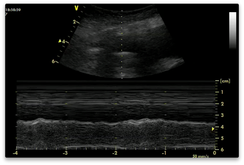 sinusoid