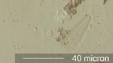 Diatom