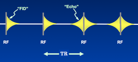 steady-state free precession (SSFP)