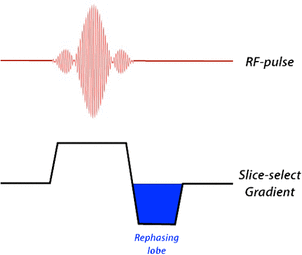 Slice-Select Rephasinglobe