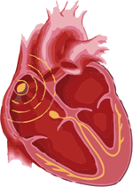 bradycardia symptoms