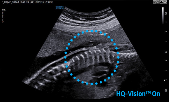 imaging solutions : HQ-Vision™ - on 