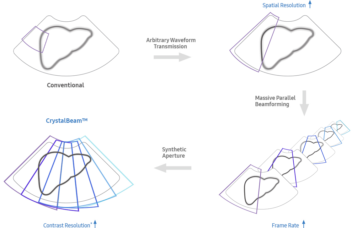 Conventional → Arbitrary Waveform Transmission(Spatial Resolution) → Massive Parallel Beamforming(Frame Rate)  → Synthetic Aperture → CrystalBeam™(Contrast Resolution)