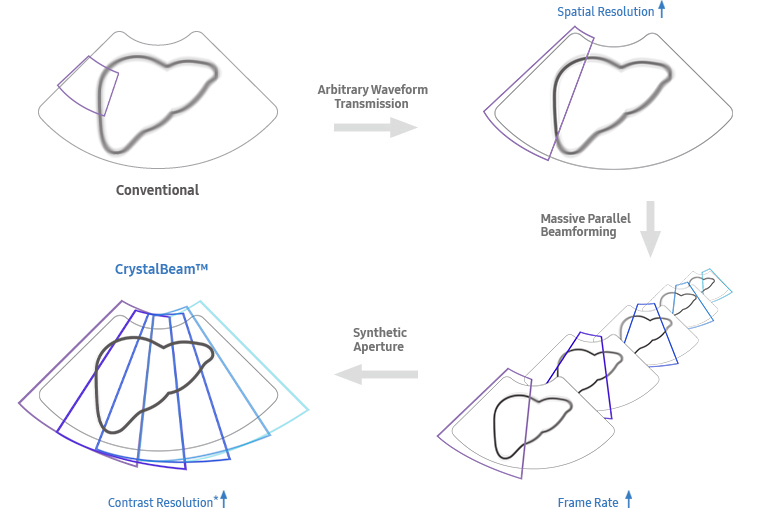 Conventional → Arbitrary Waveform Transmission(Spatial Resolution) → Massive Parallel Beamforming(Frame Rate)  → Synthetic Aperture → CrystalBeam™(Contrast Resolution)