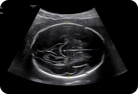 medical diagnostics : BiometryAssist™