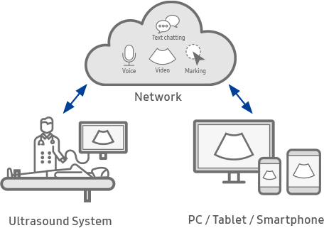 ultrasound machine with ultrasound transducer : V7