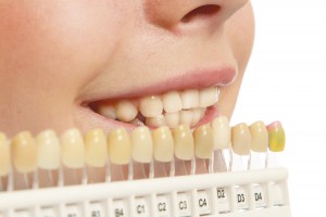 Top 5 Cosmetic Dental Procedures