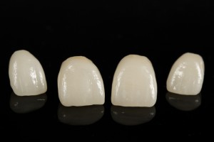 How Do Porcelain Veneers Differ From Dental Crowns?