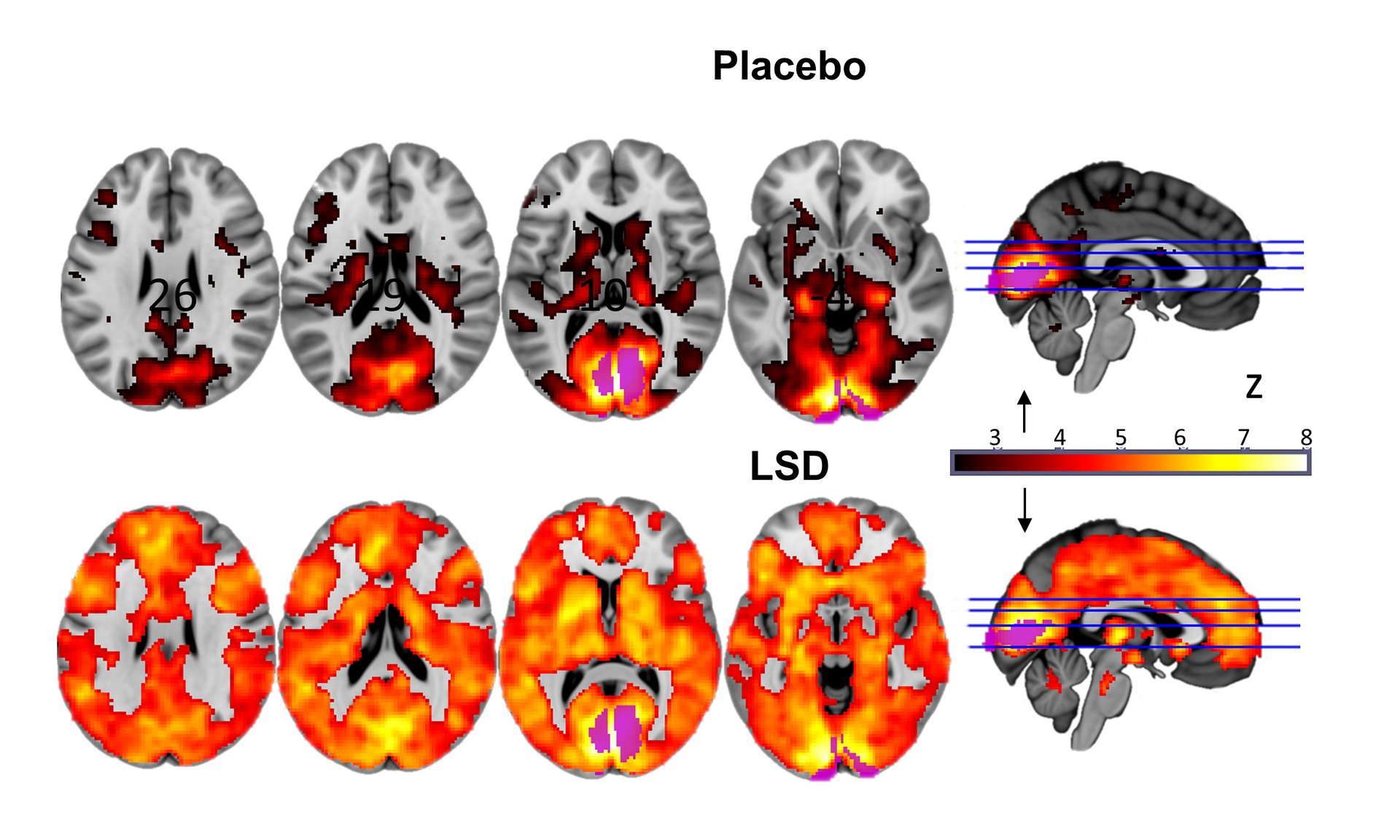 Brain-on-LSD