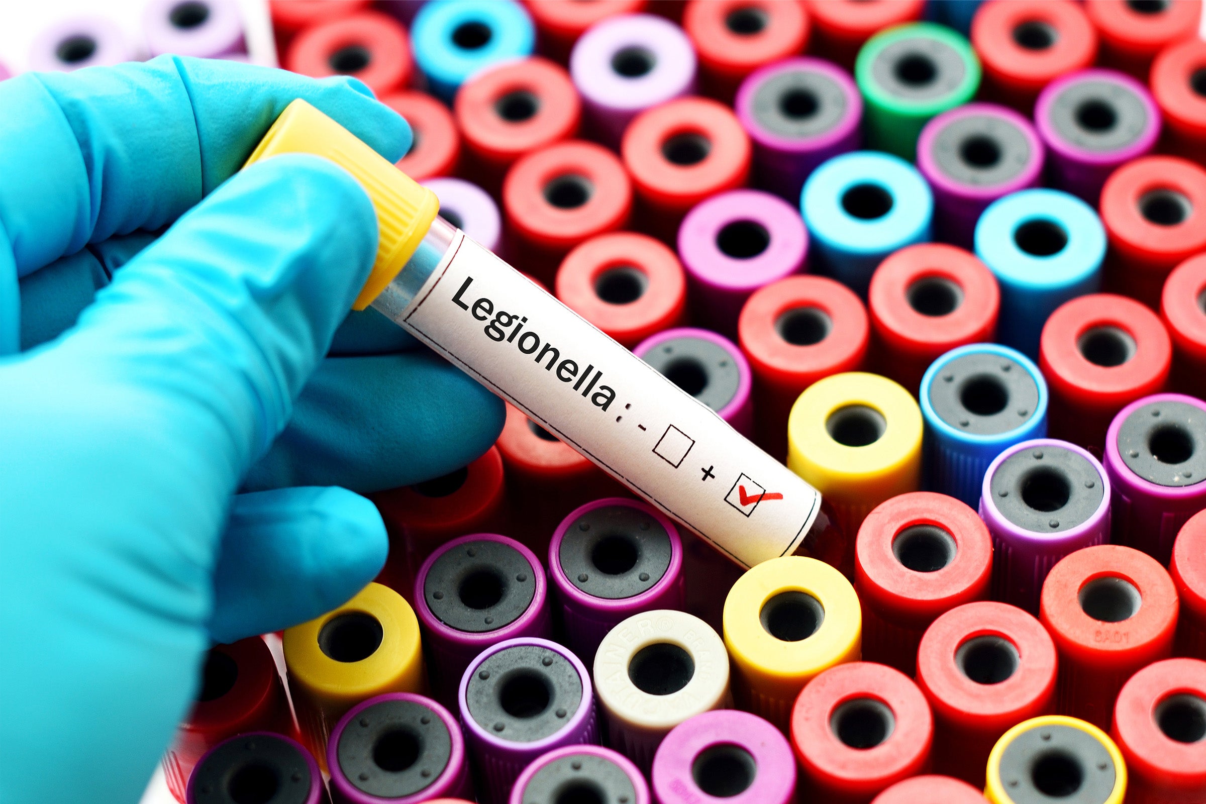 Closeup of a hand in a latex glove holding a sample in a vial that is marked as positive for legionella