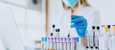 Laboratory technician working on laptop and handling test tubes