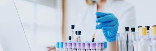 Woman wearing face mask in bright white lab observing vials while logging information on laptop