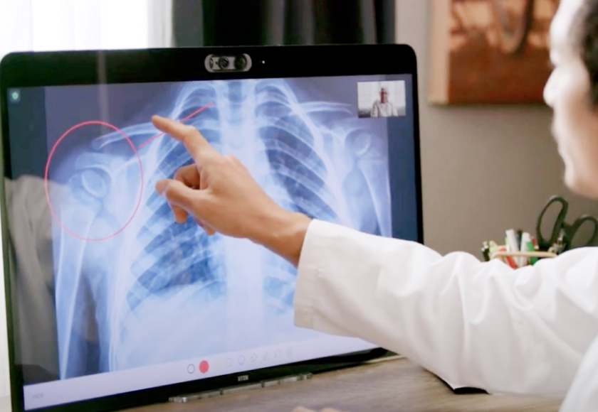 Virtuell röntgenkonsultation