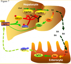 liver disease