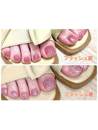 フットネイル☆フラッシュネイル