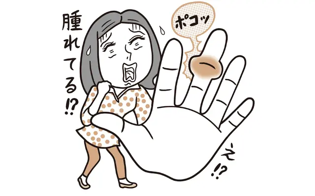 あれ？ なんだか関節、腫れてる？