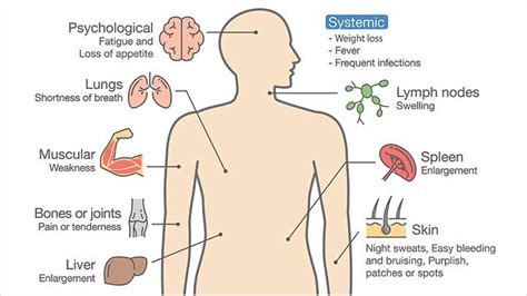 Specialist in Acute lymphoblastic leukemia treatment in India