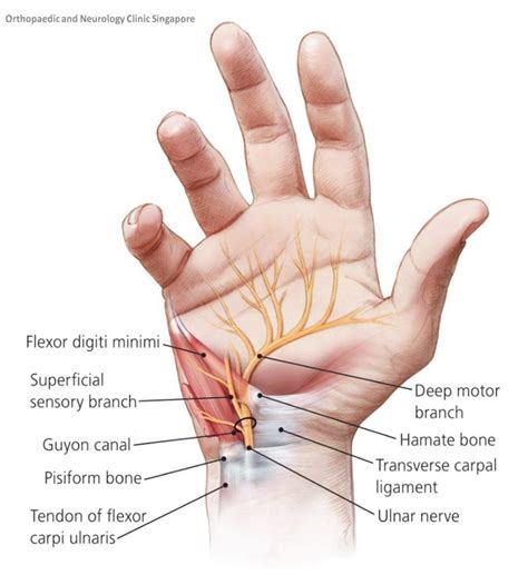 Wrist Pain [solution] | Comprehensive Hand Wrist Clinic