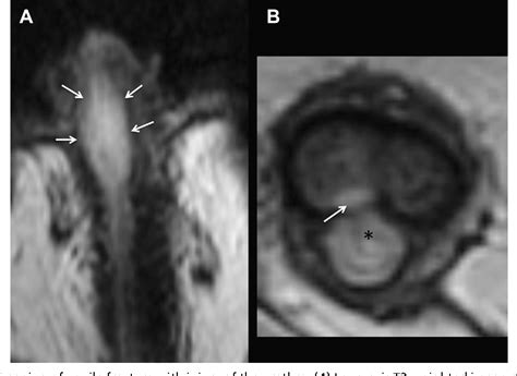 Figure 7 from Imaging of male pelvic trauma. | Semantic Scholar