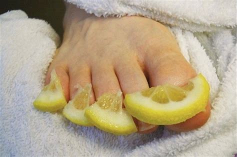 10 Effective Home Remedies For Getting Rid Of Toenail Fungus