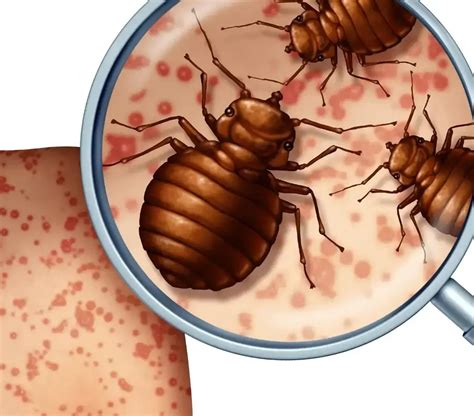 Bed Bug Removal Cost: What to Consider - Pesticontrol