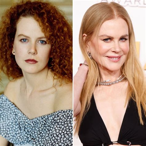 Nicole Kidman Addressed Plastic Surgery and Botox Rumors After Dramatic ...