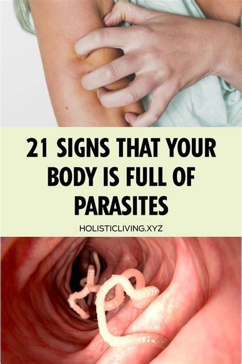 21 Signs That Your Body is Full of Parasites | Intestinal parasites ...