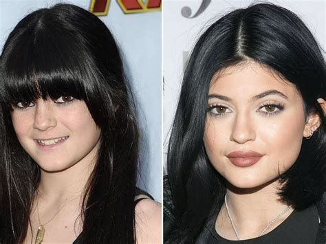 Kylie Jenner’s Lips And Nose Job; Before And After Surgery • Celebily ...