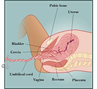 Vaginal Delivery Diagram