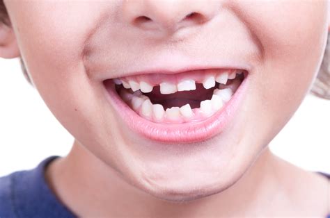 Things About Your Growing Child’s Mouth - McDonald Orthodontics