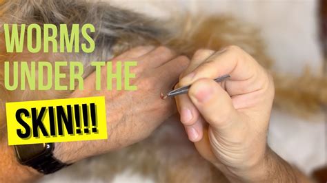 How to remove botfly from your pet - YouTube