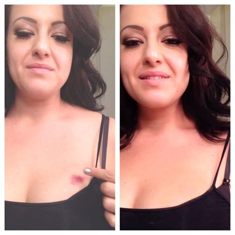 How to Cover a Hickey with Makeup - PattiKnows | Patti Stanger