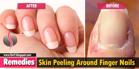 How To Remove Nails Cuticles - HOWTOREMVO