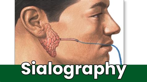 What Is Sialography: Overview, Uses, And The Procedure? How Is ...