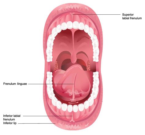 Frenulum In The Mouth - Possible Problems, Treatments, and Frenectomy