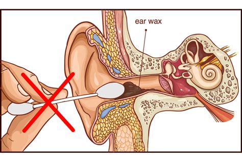 Ear Wax Anatomy