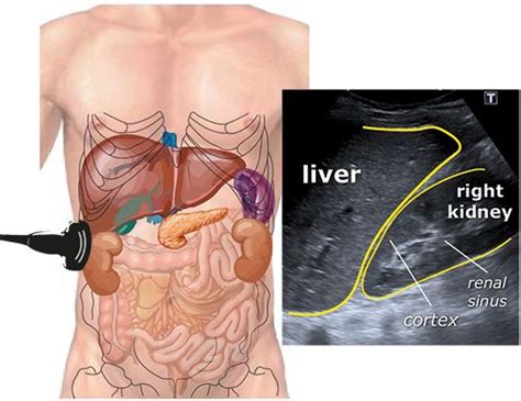 Whole Abdomen Scan W/ Directions & Pictures! 👍🏻 | Ultrasound sonography ...