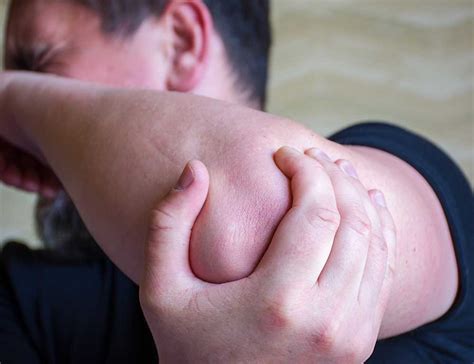 Cubital Tunnel Syndrome: Causes, Symptoms and Treatments