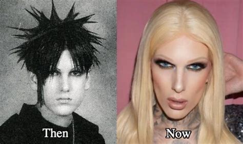 Jeffree Star Plastic Surgery Before and After Photos - Latest Plastic ...