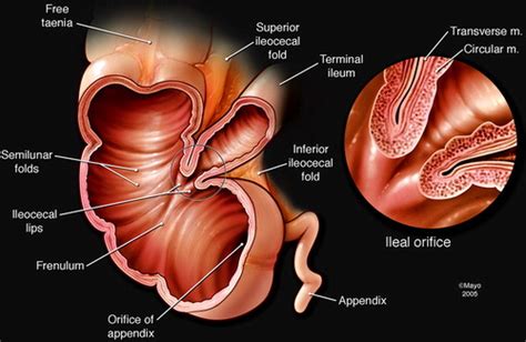 Ileocecal Valve Diagram