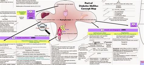 17 Best images about nursing Concept Map on Pinterest | Type 1 diabetes ...