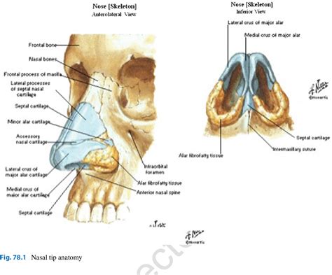 [PDF] Restoring the Drooping Tip and Hanging Columella in Revision ...