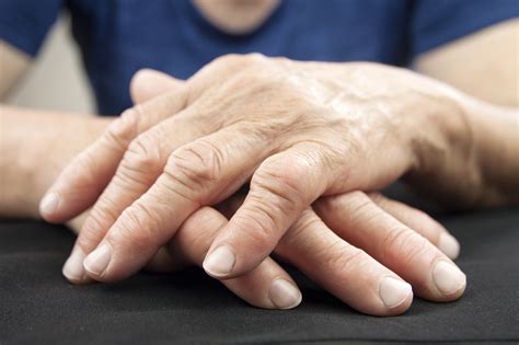 What You Need to Know About Rheumatoid Arthritis Symptoms and Treatment ...